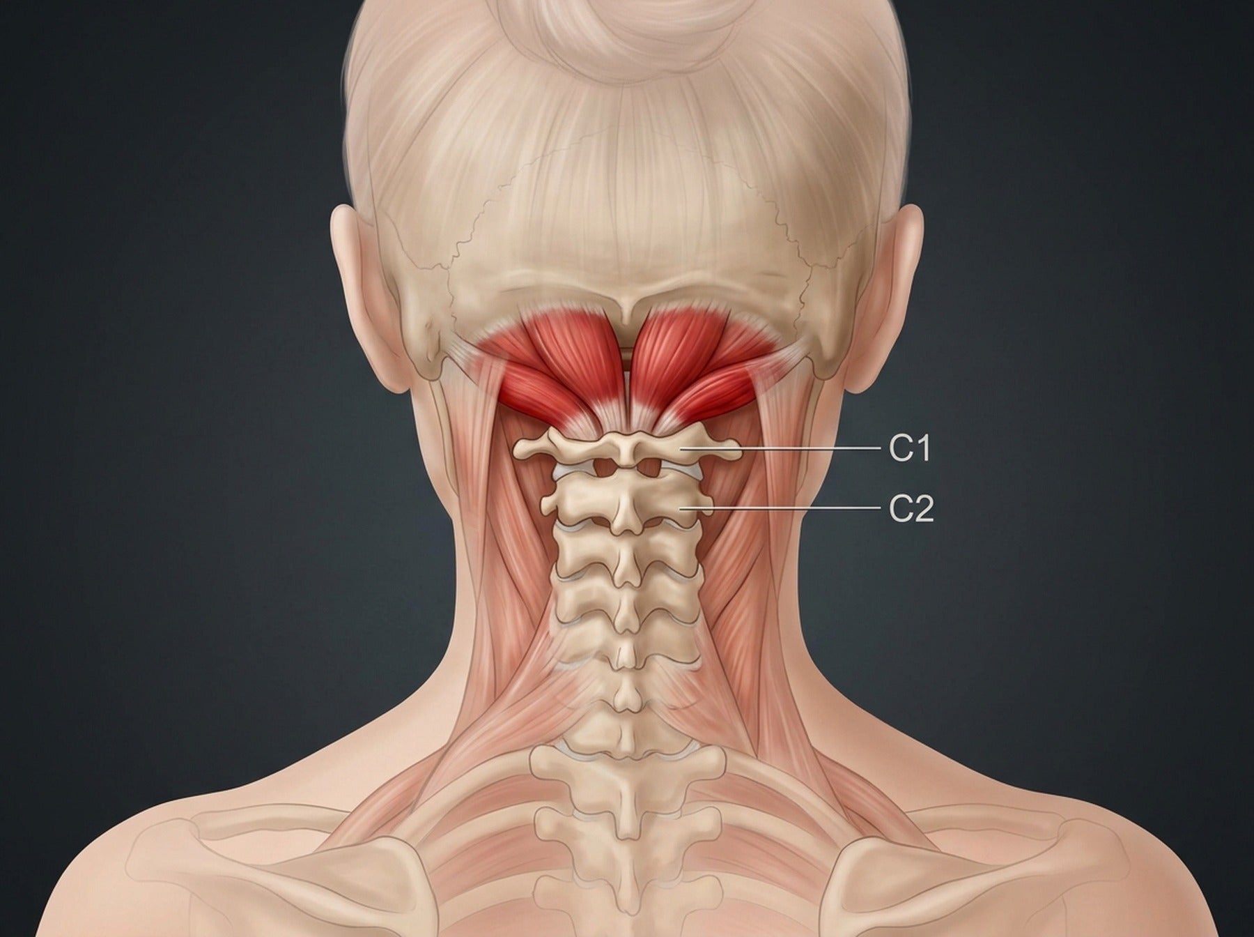 Anatomical illustration of the suboccipital muscles at C1 and C2